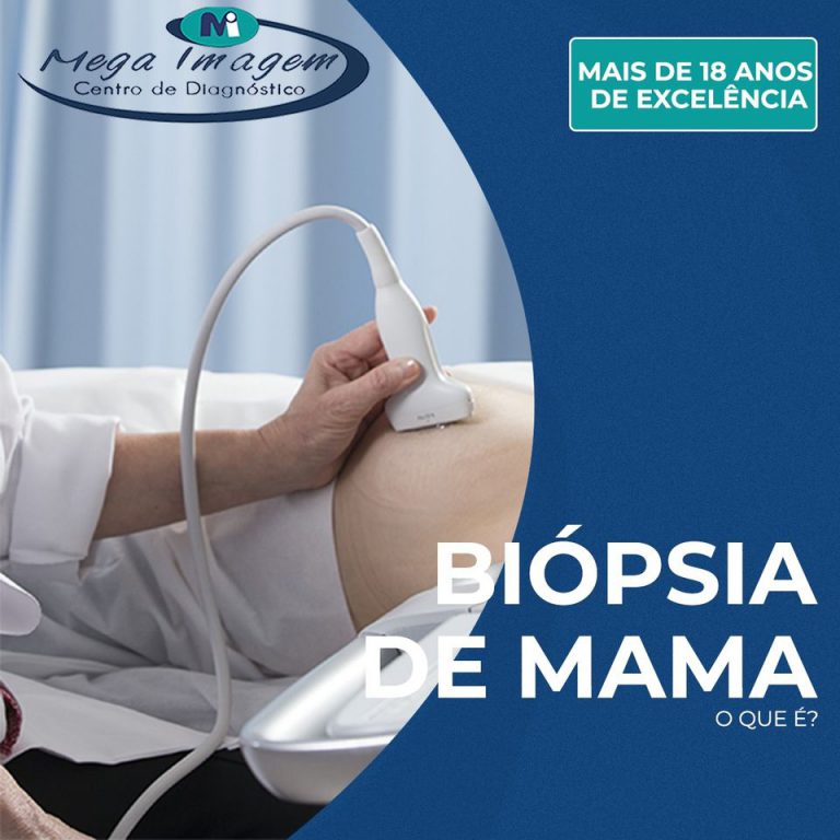 Biópsia de Mama Mega Imagem Centro de Diagnóstico Vilhena RO Colorado do Oeste RO