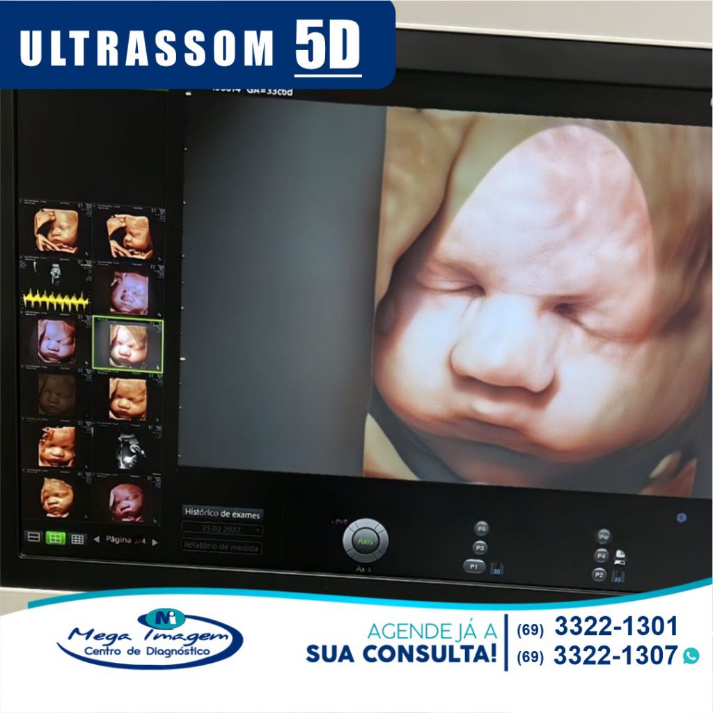 Ultrassom 5D